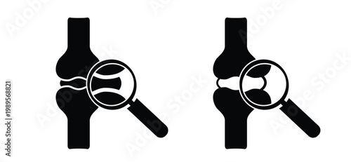 Structure of the knee joints. Cartoon knee bones. Bones icon set. Anatomy, human knee bone snatomy concept. Broken knee joint with pain. Bone joints. Science design. Human leg.