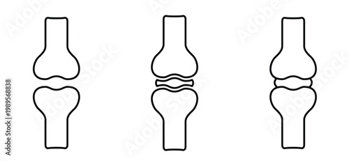 Structure of the knee joints. Cartoon knee bones. Bones icon set. Anatomy, human knee bone snatomy concept. Broken knee joint with pain. Bone joints. Science design. Human leg.