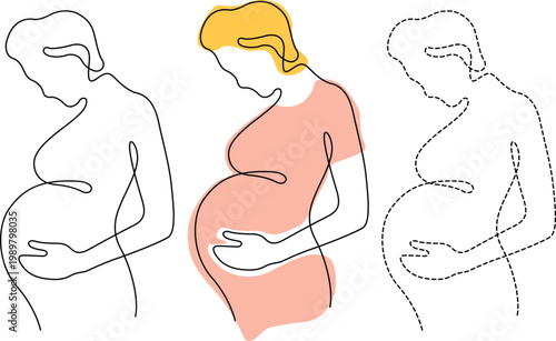 Illustrations of pregnant person and postpartum body changes Vector