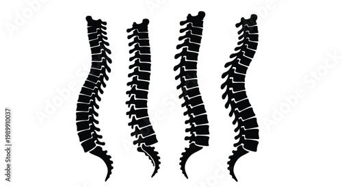 Four spinal columns depicted in a stark black silhouette