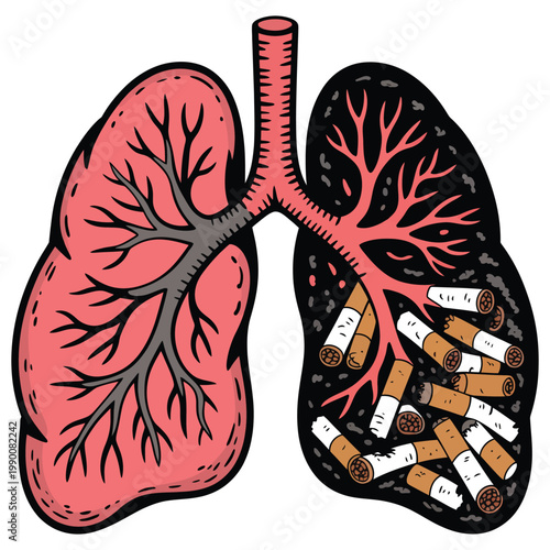 Anatomy illustration of human lungs showing contrast between healthy pink tissue and black damaged organ filled with cigarette butt waste