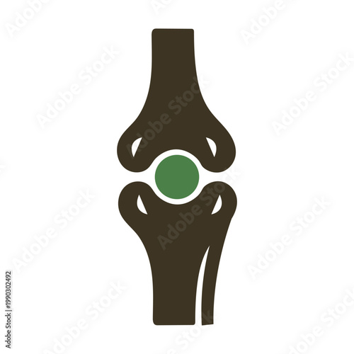 Diagram of a knee joint with prosthetic implant in place between femur and tibia