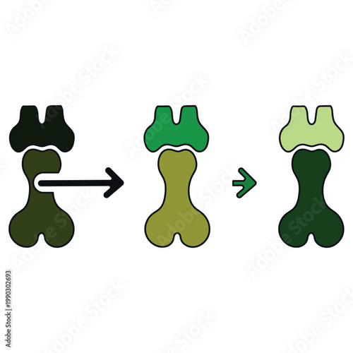 Illustration of a bone fusion and healing process through different stages