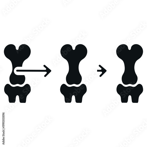 Illustration of pelvic bone movement during childbirth stages