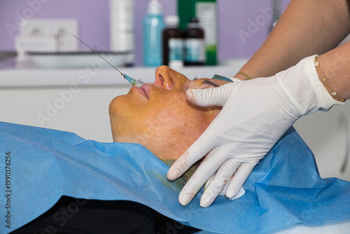 Anesthesia administered before a facelift using absorbable threads. Close-up.