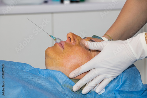 Anesthesia administered before a facelift using absorbable threads. Close-up.