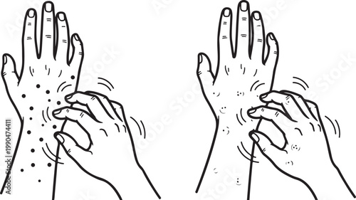 Illustration showing two hands, one with many small dots and the other massaging out those dots, representing rash or skin problem relief.