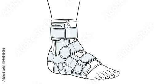 Detailed line drawing of a human foot and ankle wearing a medical orthopedic stabilization brace for injury recovery support.