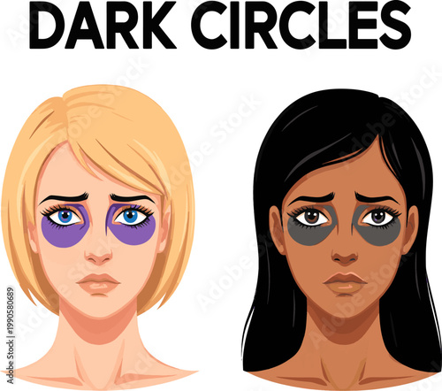Isolated a realistic kinds of deferent woman suffering from dark circles under her eyes. vector art with white background.