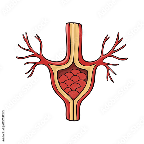 Abstract Illustration of Arterial Blockage or Blood Clot Formation in Vein