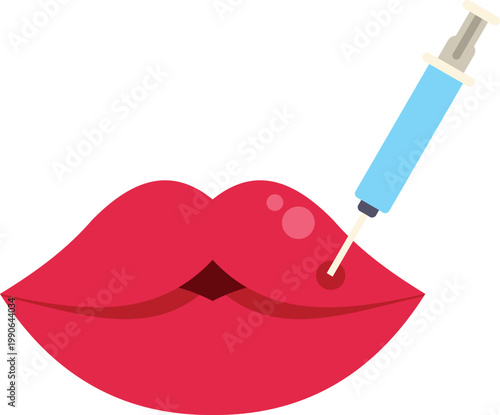 Lips undergoing a cosmetic procedure with a syringe injecting filler for beauty enhancement