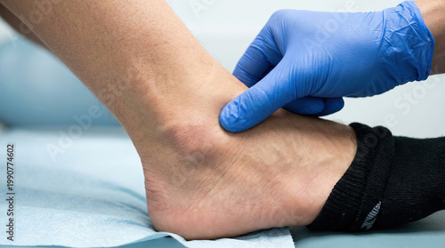 Gloved hand pressing ankle medical examination injury assessment healthcare professional blue glove patient foot physical therapy close up clinical setting pain evaluation