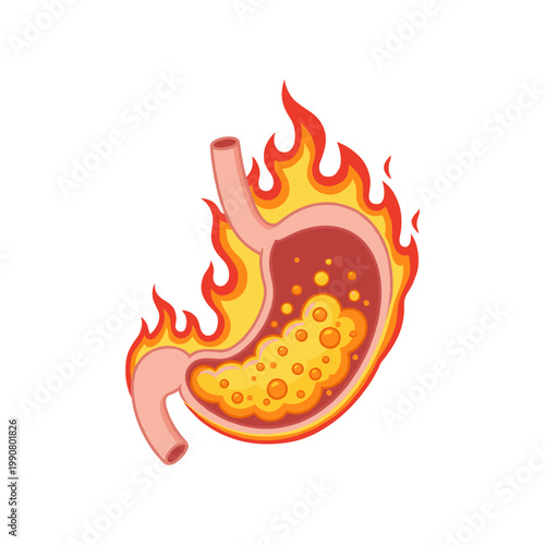 Stylized human stomach on fire with bubbling contents keywords: stomach, heartburn, indigestion