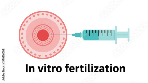 Medical illustration of in vitro fertilization process with syringe and egg cell