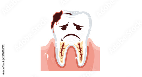 Sad cartoon tooth with a large cavity and decay representing the importance of dental health and consequences of poor hygiene.