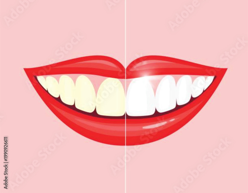 Smiling woman showing teeth with red lips and tongue in a cartoon dental style illustration