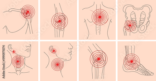 Human body joint pain and inflammation medical illustration set with shoulder, knee, spine, hip, neck, jaw, and ankle on beige background