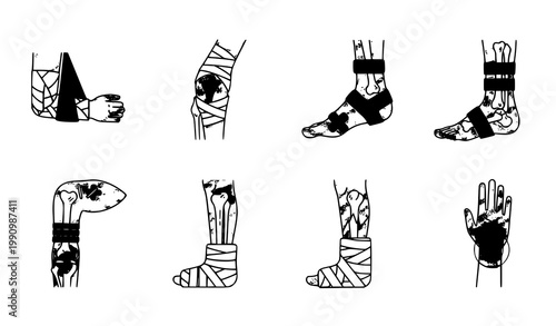 A set of vector illustrations showing various bandaged limbs and hands