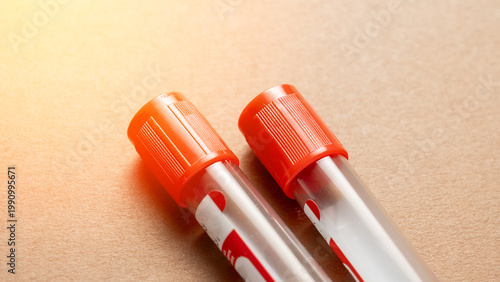 Two transparent blood collection tubes rest on a textured surface. Orange caps feature raised ridges for secure handling. Red labeling indicates their medical use