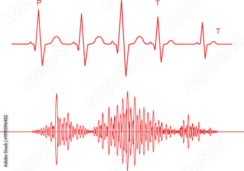 A visual comparison showing a standard electrocardiogram waveform alongside a phonocardiogram signal Vector