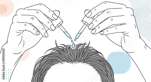 Person applying hair growth serum or medicinal oil to the scalp using two droppers for effective treatment of hair loss or thinning.