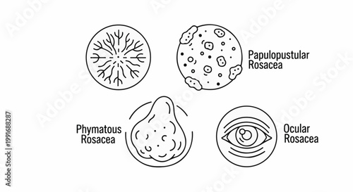 Medical illustrations of skin condition types and eye symptoms