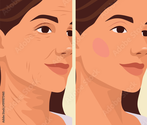 Vector illustration of a woman before and after skincare and rejuvenation procedures. Signs of aging include wrinkles and smooth, renewed skin. Use for cosmetic, dermatological, anti-aging treatments