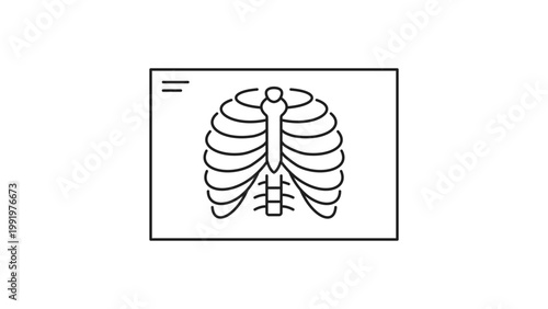 X-ray Film Vector Icon with Editable Stroke: Minimalist Black Line Illustration of a Human Rib Cage and Spine on a Rectangular Radiograph, Scalable Medical Diagnostic Imaging Graphic.