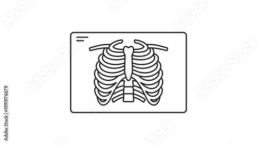Chest X-ray Film with Rib Cage and Sternum Minimalist Black Line Vector Icon Illustration on White Background; Featuring Editable Stroke for Customizable Line Weight in Medical Healthcare Design.
