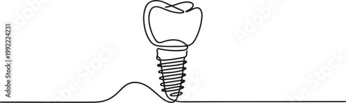 One continuous line illustration of a dental implant, isolated on white background.one line drawing vector illustration