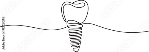 One continuous line illustration of a dental implant, isolated on white background.one line drawing vector illustration