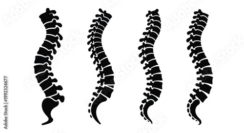 Four spinal columns depicted in a striking black silhouette