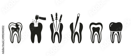 Root Canal Treatment Procedure Icons, Dental Care Stages Infographic Showing Tooth Decay Repair, Filling, Pulp Removal and Crown Restoration, Medical Silhouette Collection for Dentist Office Education