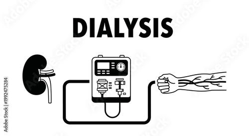 Kidney Dialysis Process Medical Vector Illustration.