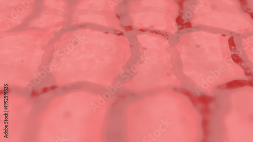  Skin Cells up Close on Human Dermis - Rosacea of Enflamed Psoriasis