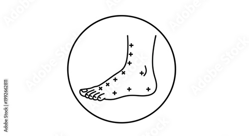 Acupuncture points on foot, medical illustration, pain relief, alternative therapy