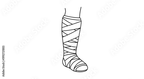 Illustration of a leg wrapped in a detailed cast with crisscross bandages, black and white minimalist style, isolated on a plain background