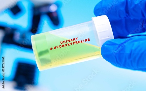 Assesses levels of 4-hydroxyproline to evaluate collagen