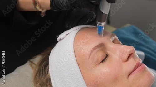 Cosmetologist performing a microneedling mesotherapy procedure on a woman's forehead in a spa