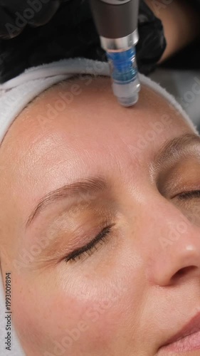 Cosmetologist performing fractional mesotherapy on a woman's forehead in a beauty salon