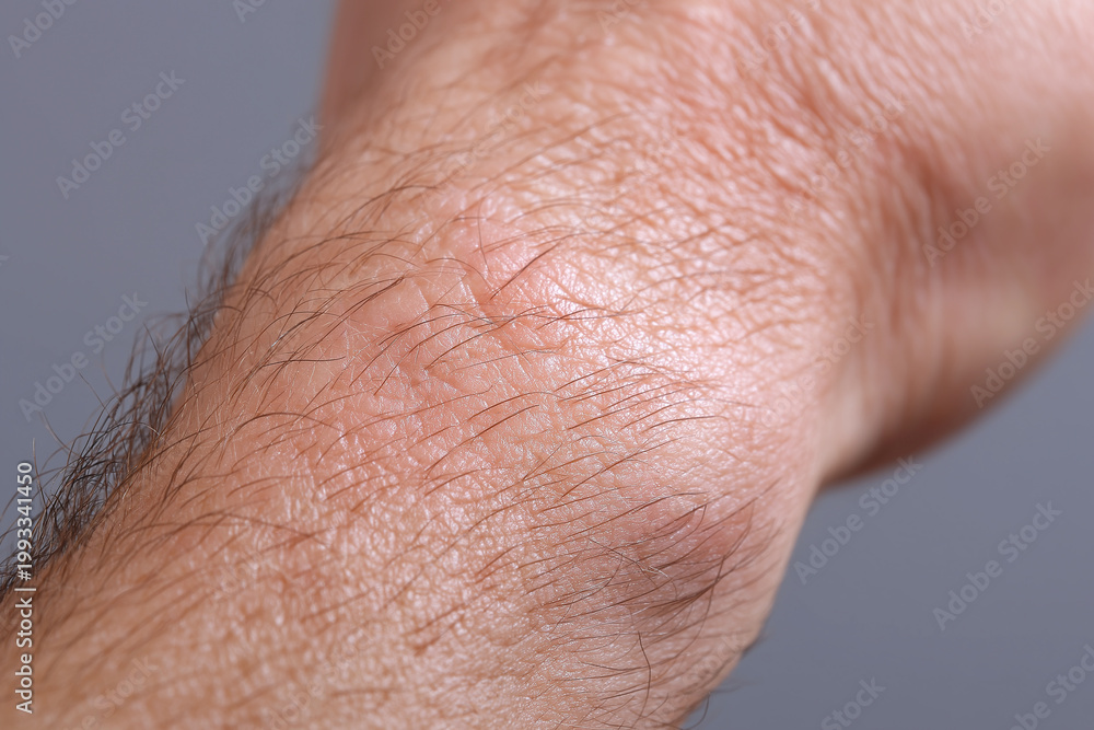 Fototapeta premium Ultra close up skin morning light glow natural pores skin close up macro forearm hair texture pore adult male healthy detail natural light skin tone dermatology epidermis hairy wrist arm skin care