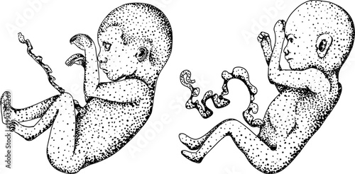 Hand drawn illustration set in a dark plague doctor theme, medieval medicine, anatomy, and occult aesthetics. Vintage engraving style, suitable for gothic, historical, and dark