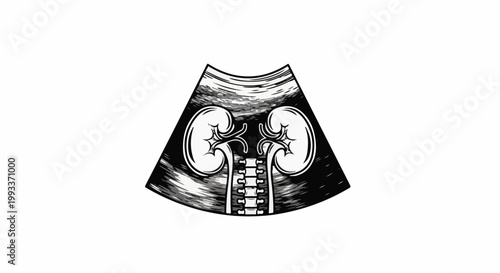 Ultrasound image of kidneys and spinal column in monochrome