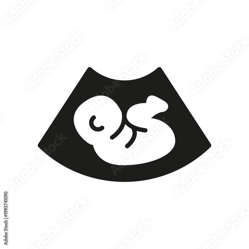 Ultrasound baby scan icon. Simple black ultrasound fetus icon for medical, prenatal and pregnancy healthcare design. Vector illustration.
