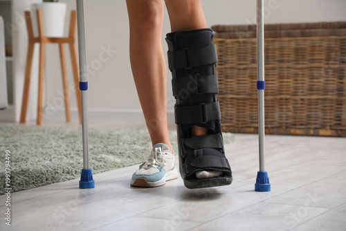 Young woman with broken leg...