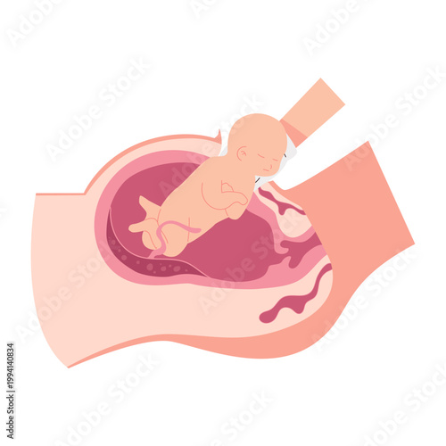 Childbirth Delivery Medical Illustrations
