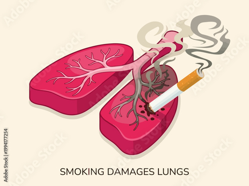Vector illustration of smoking damaging lungs with a cigarette