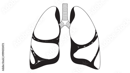 Detailed Illustration of Human Lungs Showing Bronchi and Alveoli Structure.