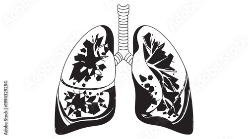 Detailed Illustration of Human Lungs Showing Internal Anatomy and Structure.