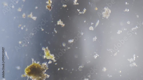 Microscopical view of water of a river with algae and microorganisms